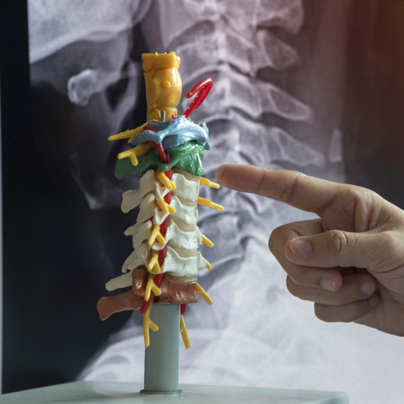 The Benefits of Cervical Traction Units for Spinal Health Brain
