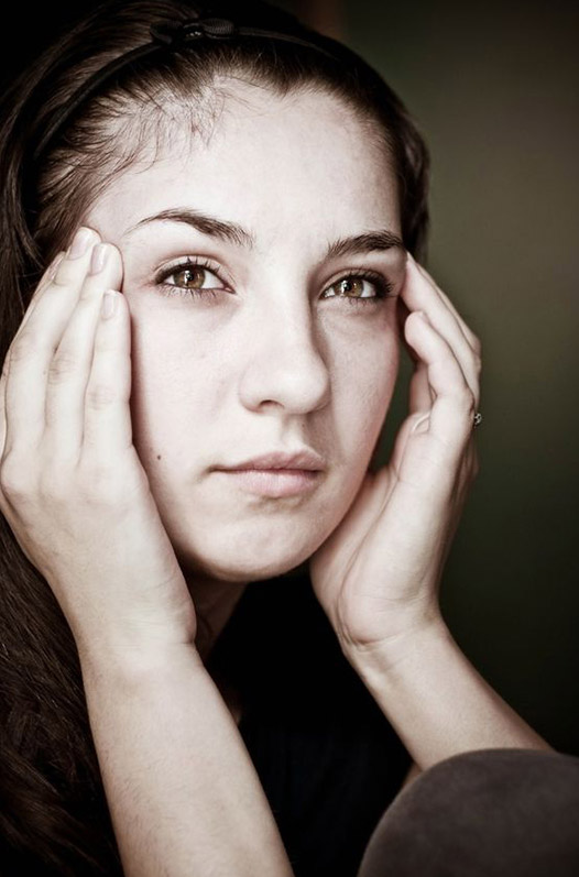 headache-migraine-vertigo-concussions